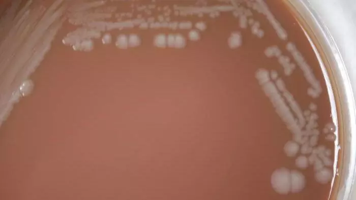 Burkholderia pseudomallei (image by CDC)