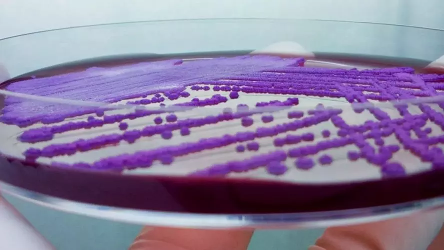 Burkholderia in Petri Dish