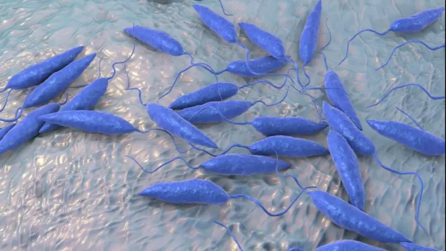 Leishmaniasis