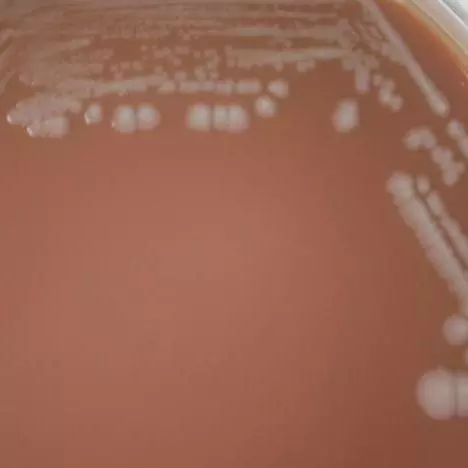 Burkholderia pseudomallei (image by CDC)