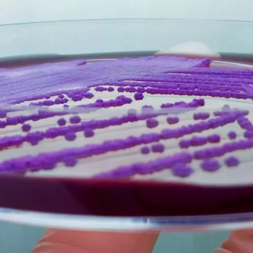 Burkholderia in Petri Dish