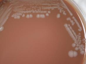 Burkholderia pseudomallei (image by CDC)