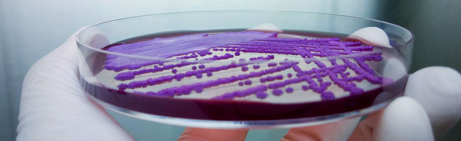 Burkholderia in Petri Dish