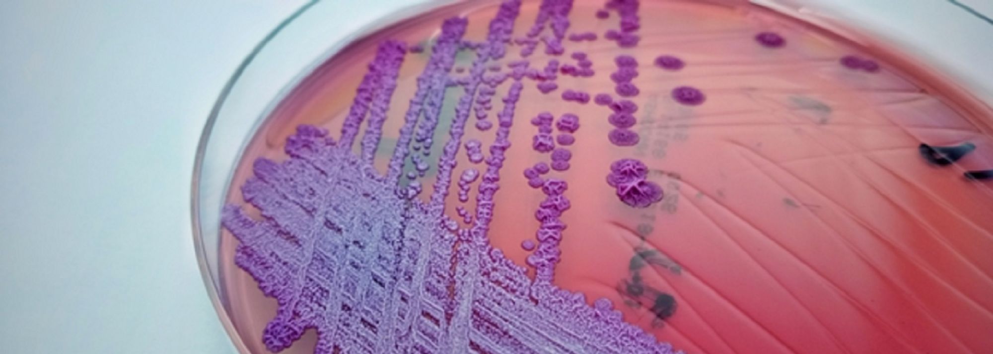 burkholderia pseudomallei banner